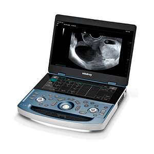 Mindray MX7 